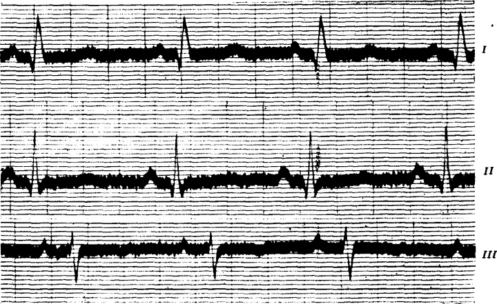 Figure 17