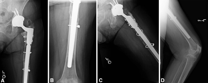 Fig. 2A–D