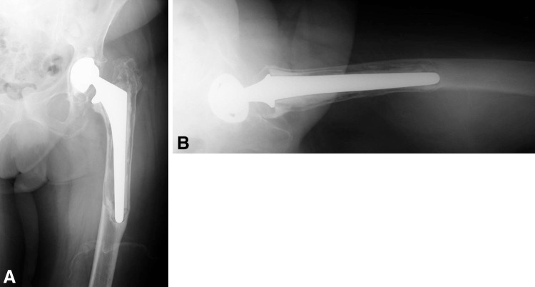 Fig. 1A–B