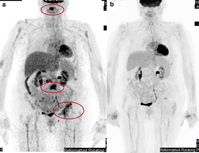 Fig. 2