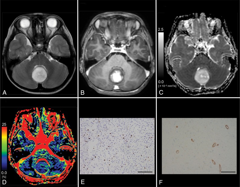 Fig 3.