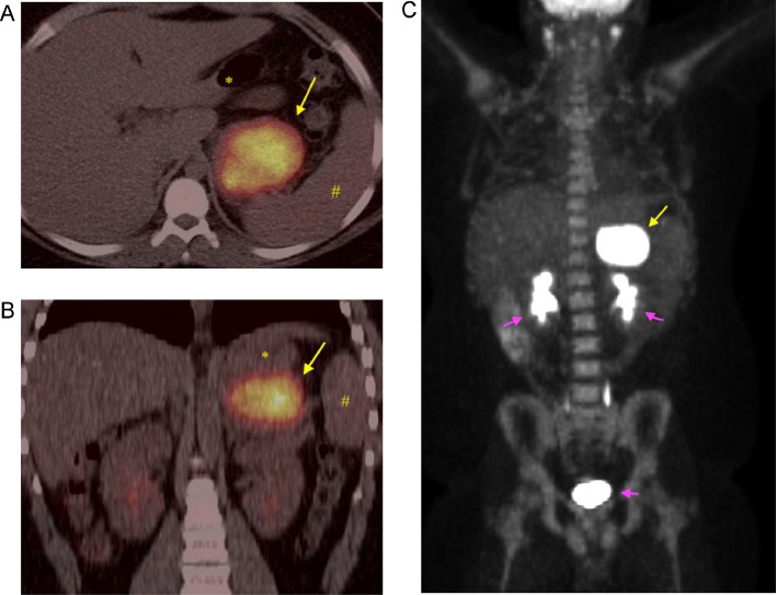 Fig 2