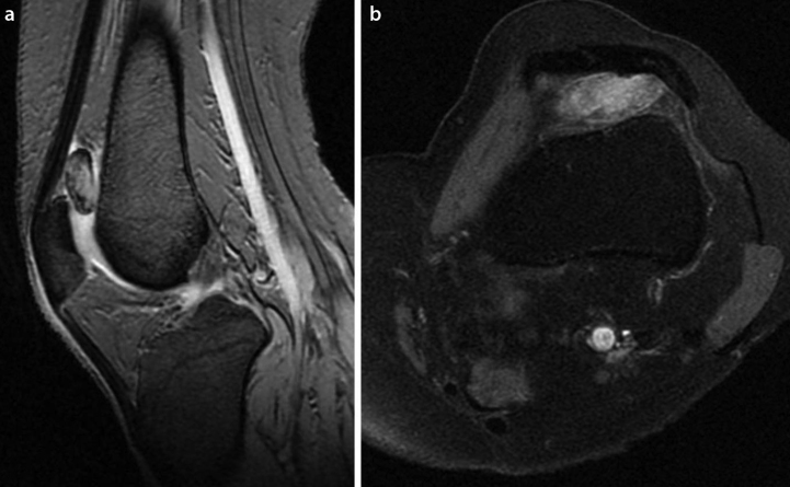 Figure 7.a, b