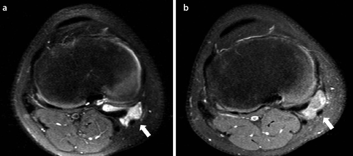 Figure 4.a, b