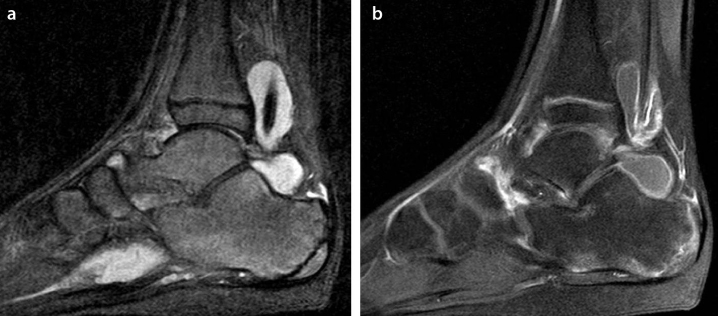 Figure 5.a, b