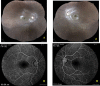 Fig. 3.