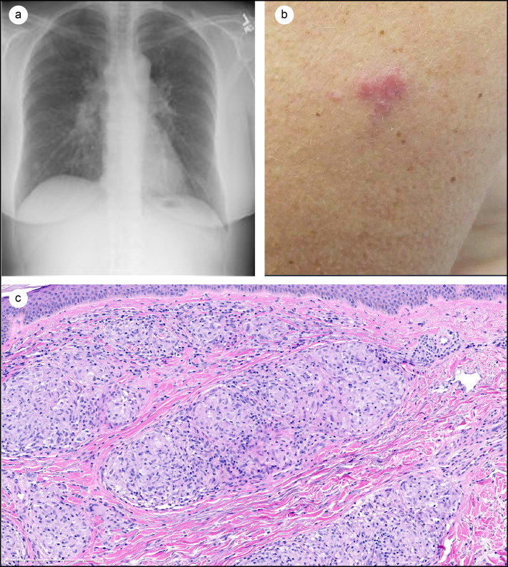Figure 1.