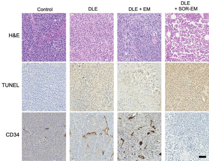 Histologic and immunohistochemical analyses of tumor tissue 2 weeks after TACE treatments. Tumor tissue specimens stained with hematoxylin-eosin (H&E), terminal deoxynucleotidyl transferase-mediated dUTP (2’-deoxyuridine 5’-triphosphate) nick-end labeling (TUNEL) stain, and human progenitor cell antigen (CD34) are shown. Brown color on the TUNEL- and CD34-stained tissue indicates TUNEL-positive apoptotic cells (TUNEL-stained specimens) and microvessels (on CD34-stained specimens) (scale bar, 25 μm). DLE = doxorubicin–Lipiodol emulsion, DLE + EM = DLE plus embolic microspheres, DLE + SOR-EM = DLE plus sorafenib-eluting EMs.