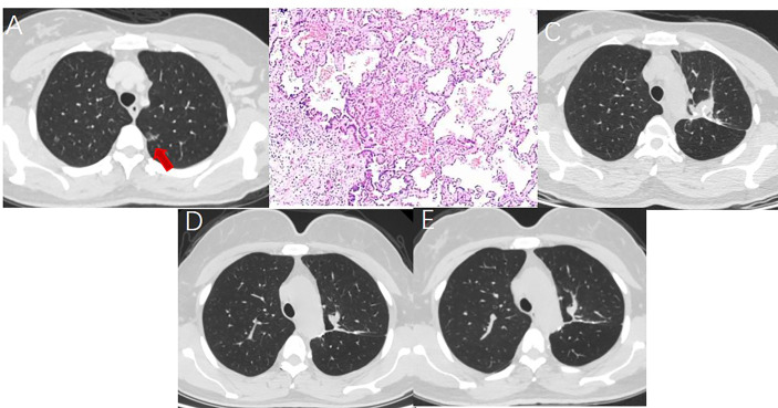 Figure 2