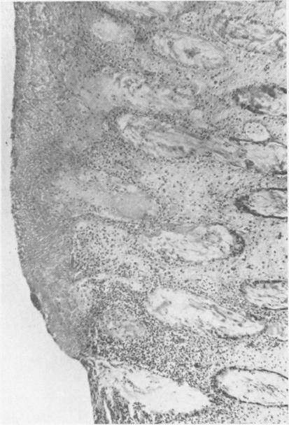 FIG. 8