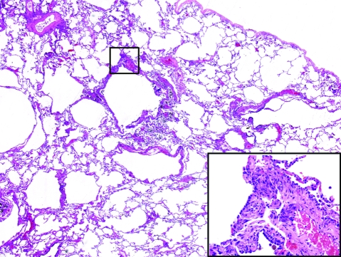 Figure 31