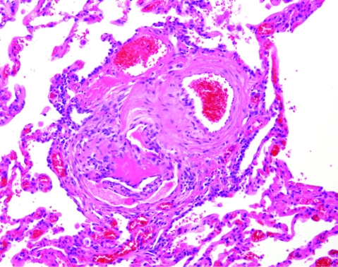 Figure 30