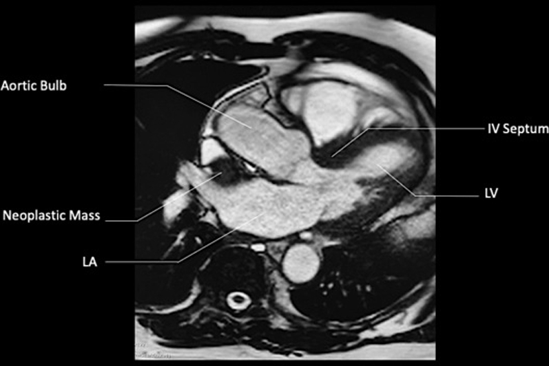 Figure 14