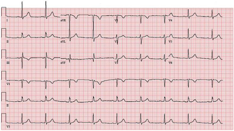 Figure 10