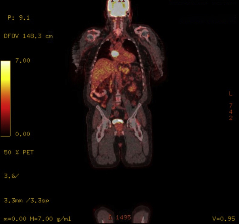 Figure 2