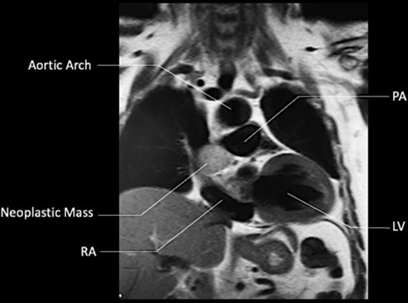 Figure 4