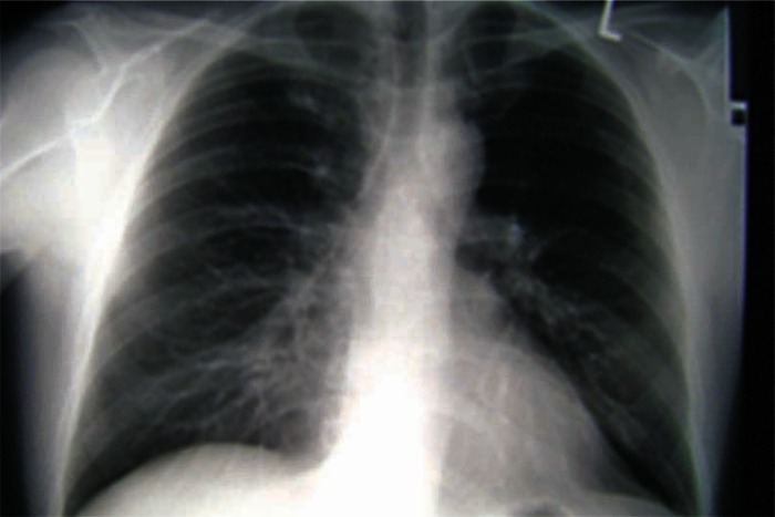 FIGURE 4: