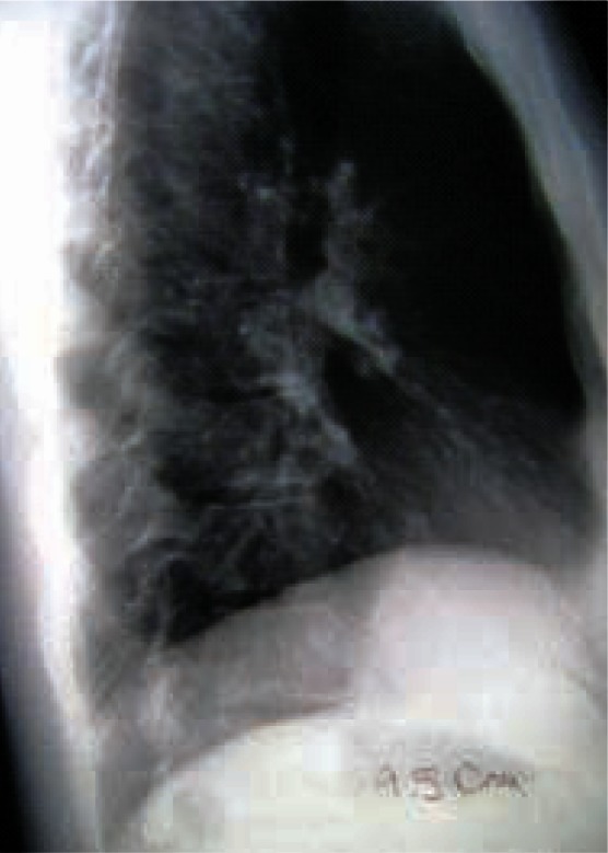 FIGURE 3: