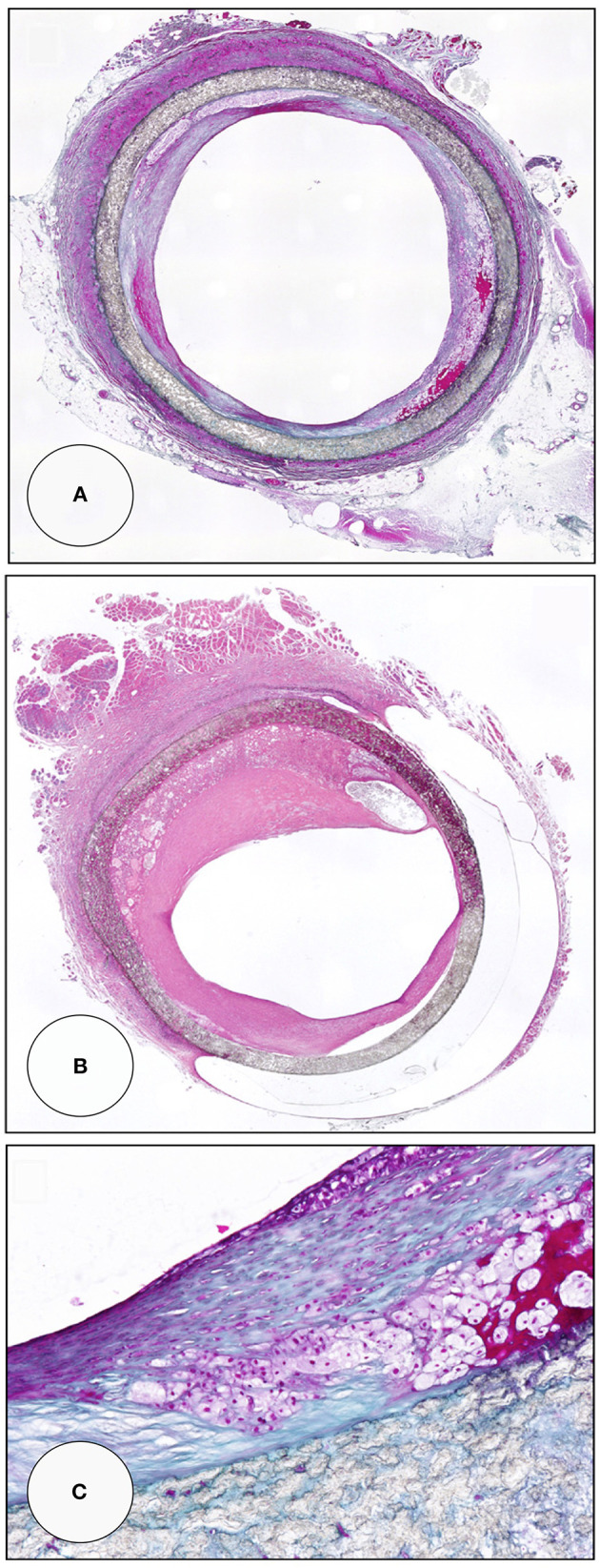 Figure 12