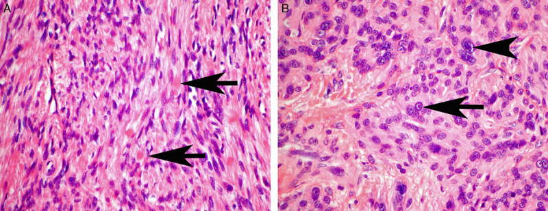 FIGURE 3