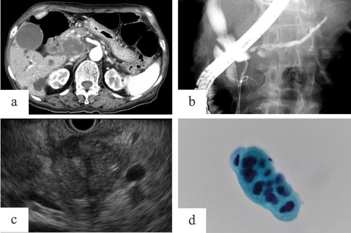 Fig. 1