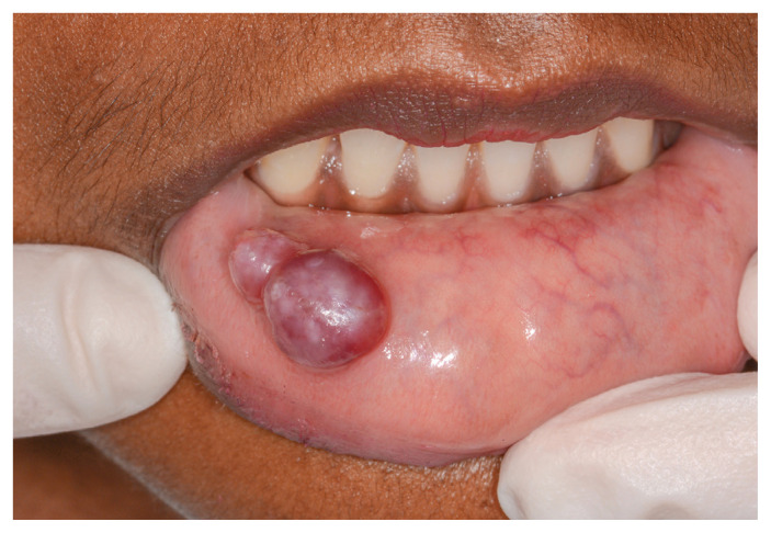 Figure 1: