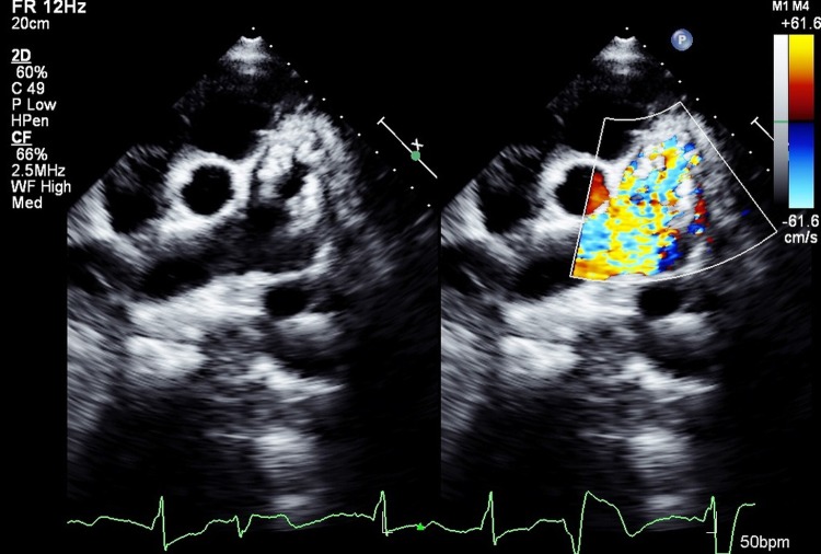 Figure 2