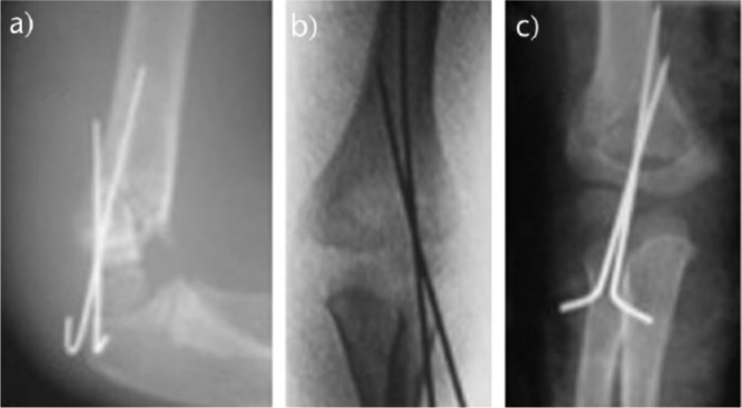 Fig. 10