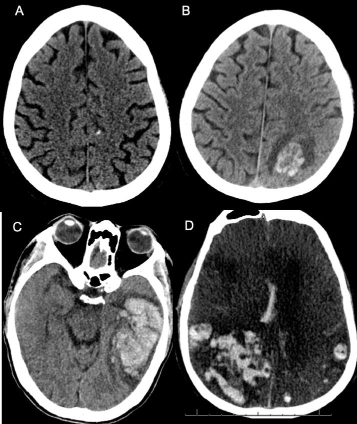 Fig. 1