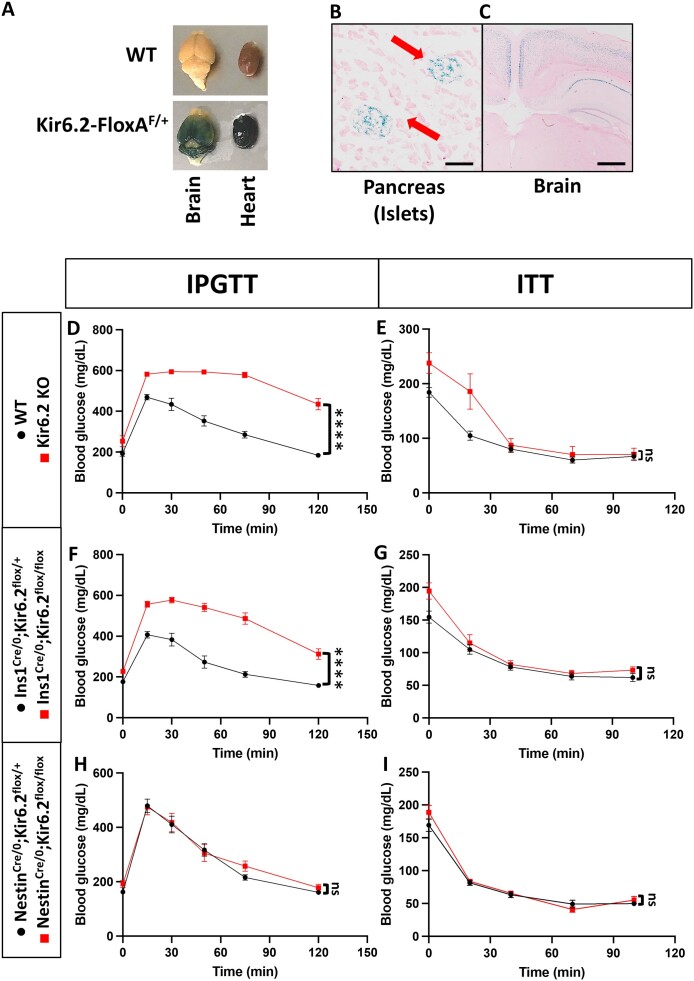 Figures of Kir6.2 expression indicated in dark colors in organs including the brain, heart, and pancreas labeled from A to C show expression in cortical and hippocampal regions in the brain, the entire heart, and pancreatic islets. Graphs depicting glucose tolerance and insulin sensitivity in mice lacking both pancreatic and neuronal, only pancreatic, or only neuronal functional KATP channels labeled from D to I show that only mice lacking functional pancreatic KATP channels have impaired glucose tolerance, in which they have elevated blood glucose levels, while insulin sensitivity remains unaltered regardless of KATP channel presence.