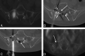 Fig 3.