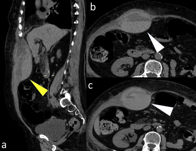 Fig. 1