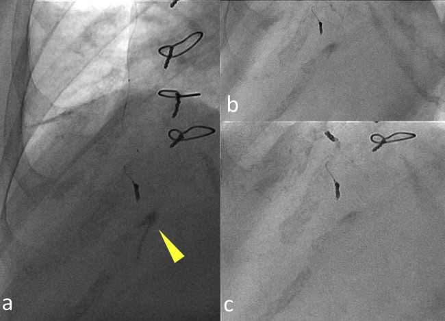 Fig. 4