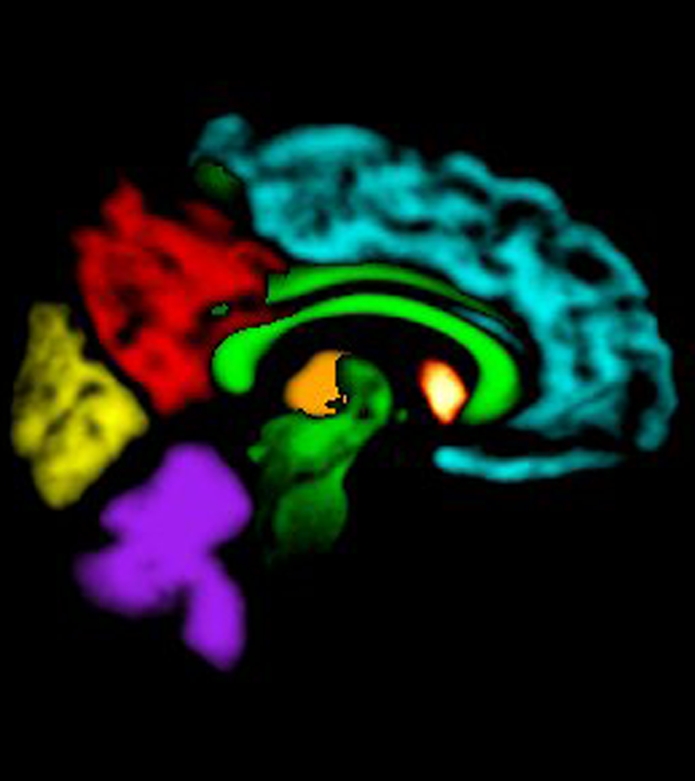 Figure 1b: