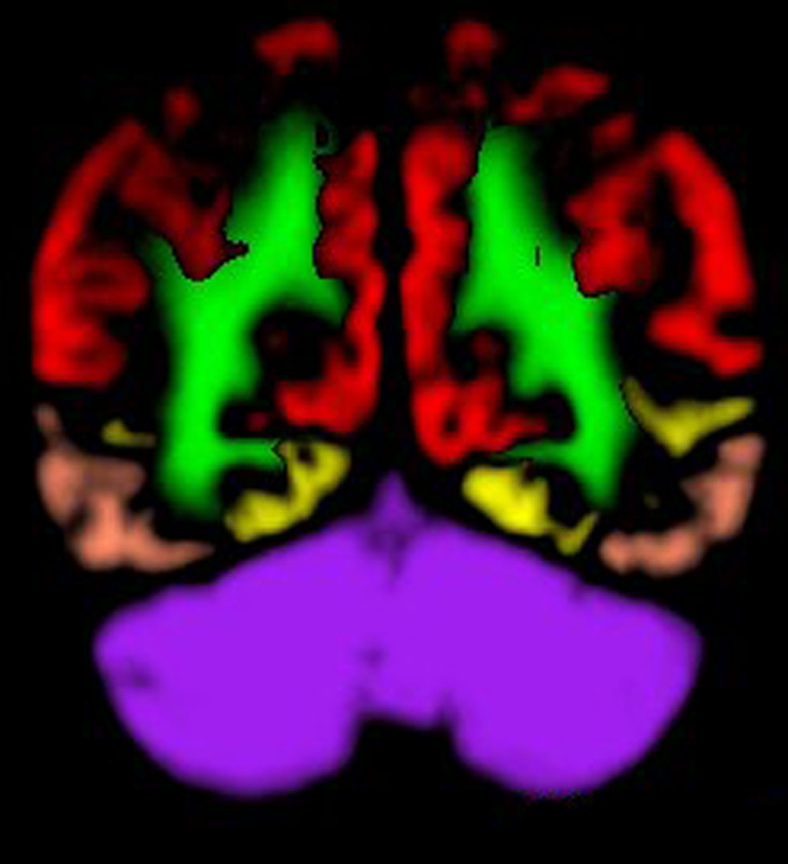 Figure 1c: