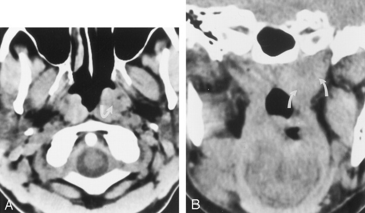 Fig 2.