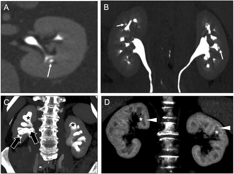 Fig 15.