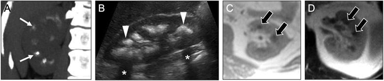 Fig 3.