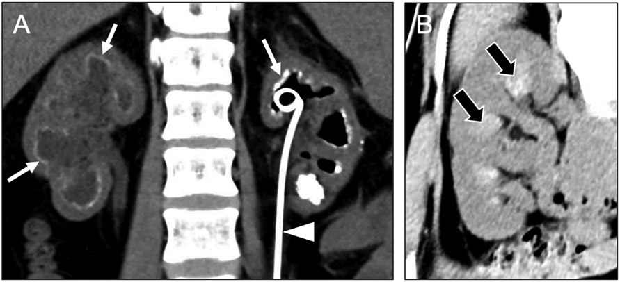 Fig 6.