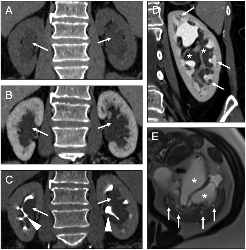 Fig 13.