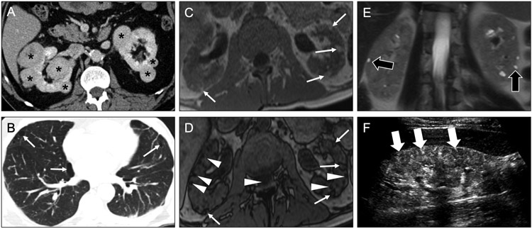 Fig 20.