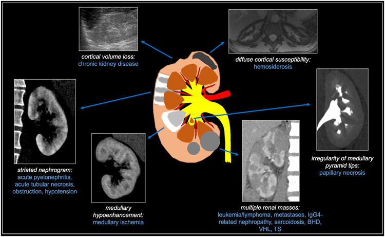 Fig 14.