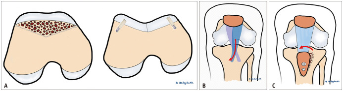 Fig. 12