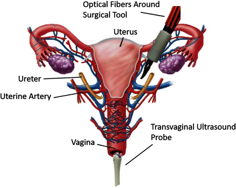 Fig. 1