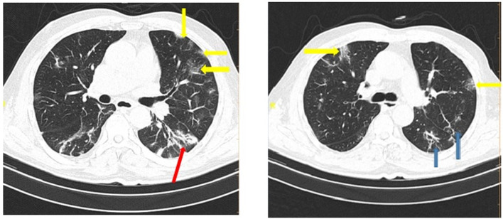 Fig 1