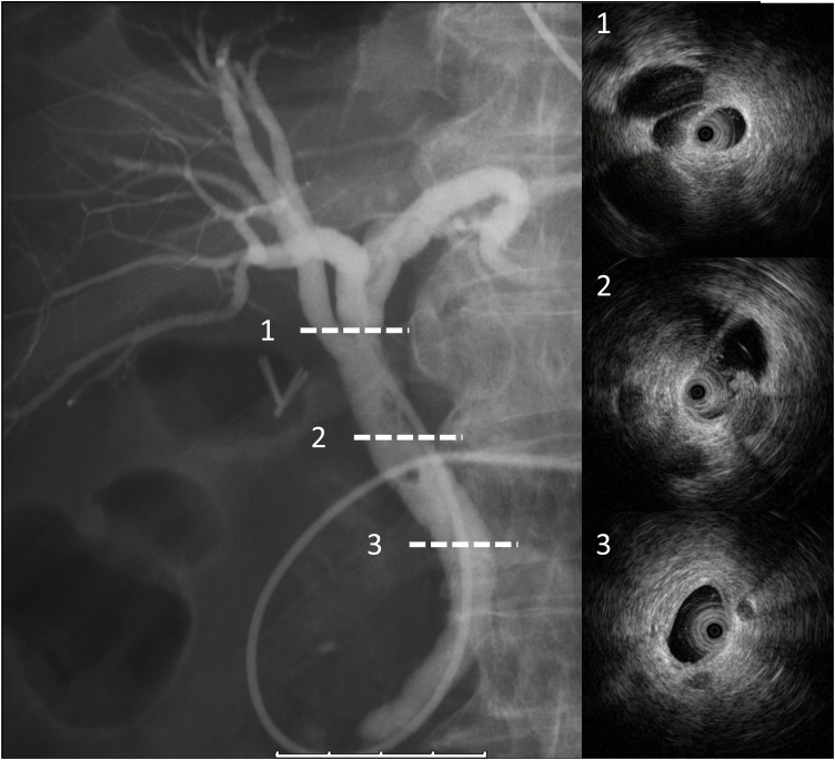 Fig. 3