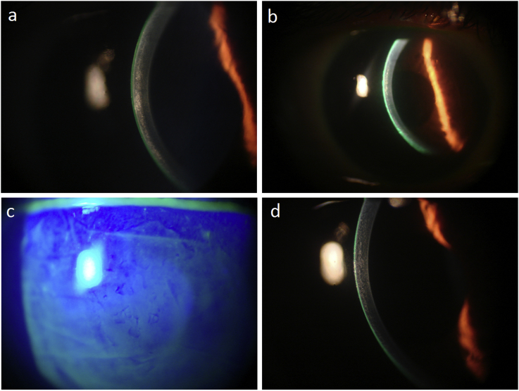 Fig. 2