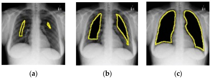 Figure 14
