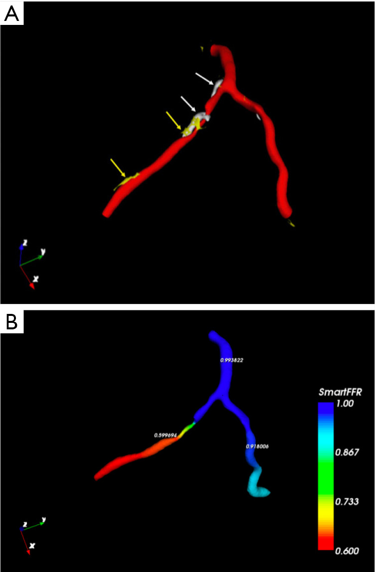 Figure 9