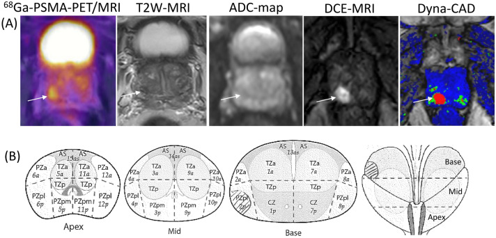 Fig. 1